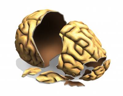 Brain Rip Off Hijacked Brains & the Question of Social Stigma